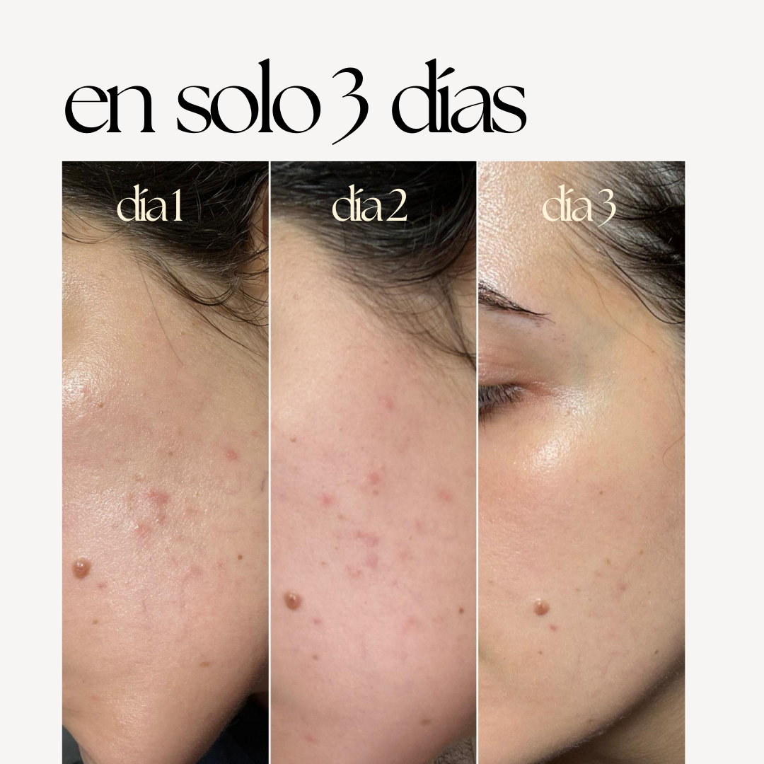 SERUM SKIN CORRECT